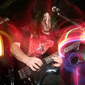 Dying Fetus - List pictures