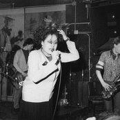 X-ray Spex - List pictures