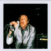 Stitches - List pictures