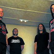 Dying Fetus - List pictures