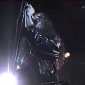 Anorexia Nervosa - List pictures