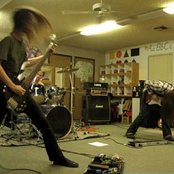 Dysrhythmia - List pictures