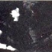 Live Skull - List pictures