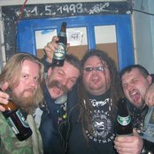 Malignant Tumour - List pictures