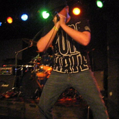 Atrophy - List pictures