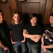 Nodes Of Ranvier - List pictures