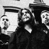 Dysrhythmia - List pictures