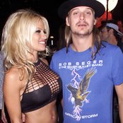Kid Rock - List pictures