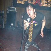 The Epoxies - List pictures