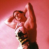 Bumblefoot - List pictures