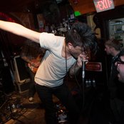 Retox - List pictures