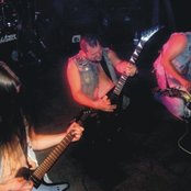 Malignant Tumour - List pictures