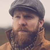 Alex Clare - List pictures