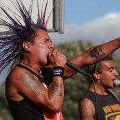 Casualties - List pictures