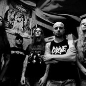 Severe Torture - List pictures