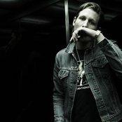 Burns - List pictures