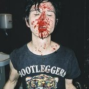 Head Wound City - List pictures