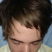 Benoit Pioulard - List pictures