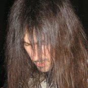 Bumblefoot - List pictures