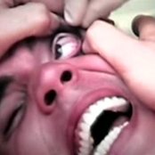 Steve-o - List pictures