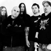 Cataract - List pictures