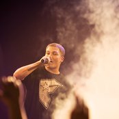 Cheek - List pictures