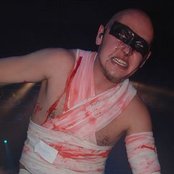 Hämatom - List pictures