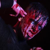 Agonoize - List pictures