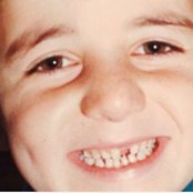 Max Gazzè - List pictures