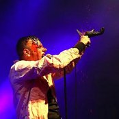 Agonoize - List pictures