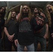 Severe Torture - List pictures