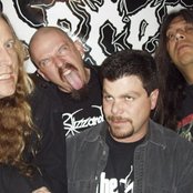 Abscess - List pictures