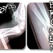 The Abyss - List pictures