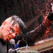 Agonoize - List pictures