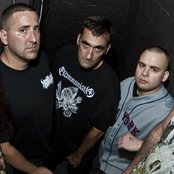 Internal Bleeding - List pictures