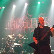 Dying Fetus - List pictures