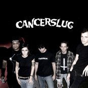 Cancerslug - List pictures