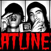 The Flatliners - List pictures