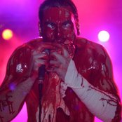 Haemorrhage - List pictures